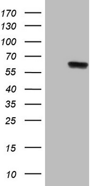 HEK293T cells were transfected with the pCMV6-ENTRY control (Left lane) or pCMV6-ENTRY PHGDH (Right lane) cDNA for 48 hrs and lysed