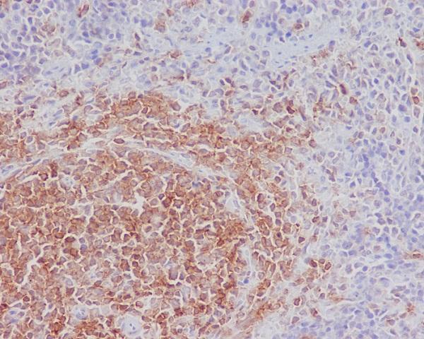 m03358 ihc