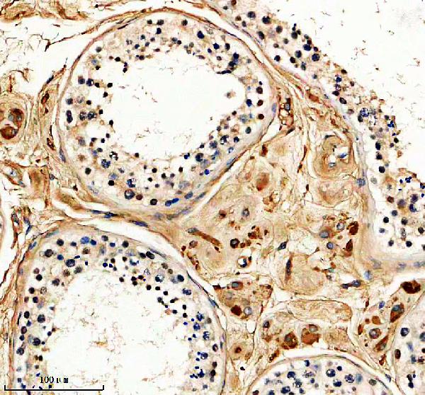 m03360 alkbh5 primary antibodies ihc testing 1
