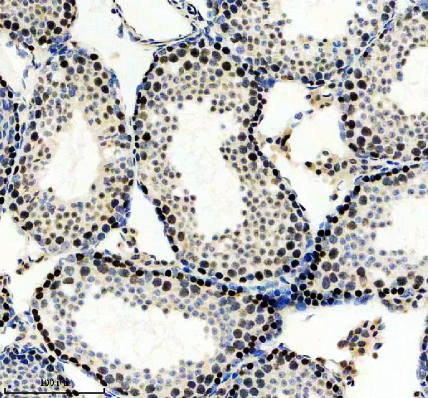 m03360 alkbh5 primary antibodies ihc testing 2