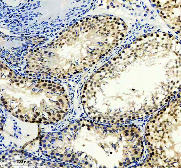 m03360 alkbh5 primary antibodies ihc testing 3