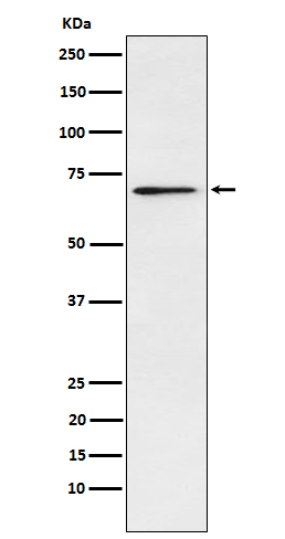 Western blot analysis of Plastin L expression in Jurkat cell lysate