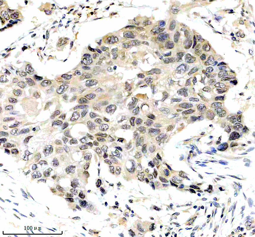IHC analysis of PIK3R2 using anti-PIK3R2 antibody (M03363-2)
