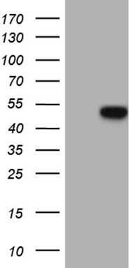 HEK293T cells were transfected with the pCMV6-ENTRY control (Left lane) or pCMV6-ENTRY GC (Right lane) cDNA for 48 hrs and lysed