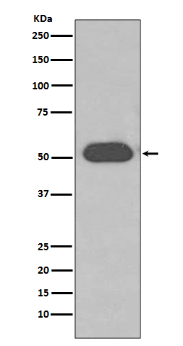 Western blot analysis of GC/VDBP expression in Human plasma lysate