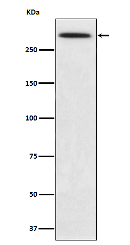 Western blot analysis of SPTA1 expression in K562 cell lysate