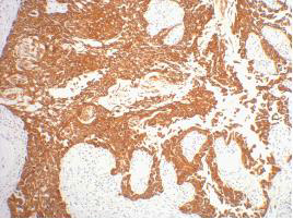Immunohistochemistry validation of KRT16 using Anti-CK16 KRT16 Monoclonal Antibody (M03393-1)