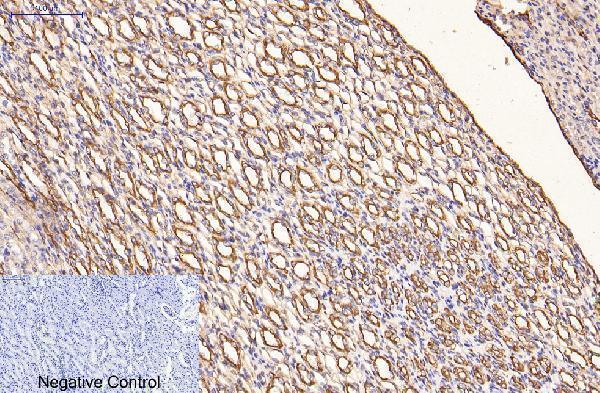 m03393 1 krt16 primary antibodyes ihc testing 10