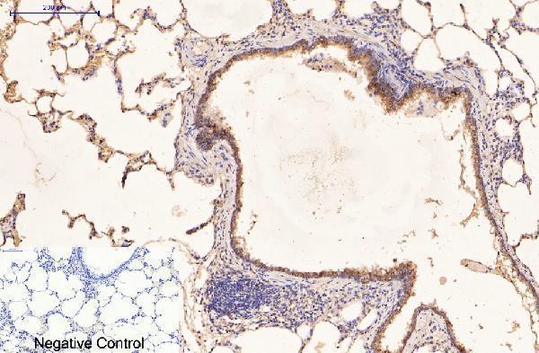m03393 1 krt16 primary antibodyes ihc testing 11
