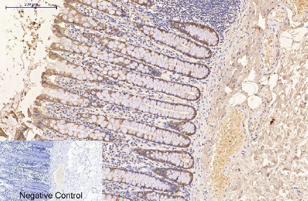 Immunohistochemistry validation of KRT16 using Anti-CK16 KRT16 Monoclonal Antibody (M03393-1)