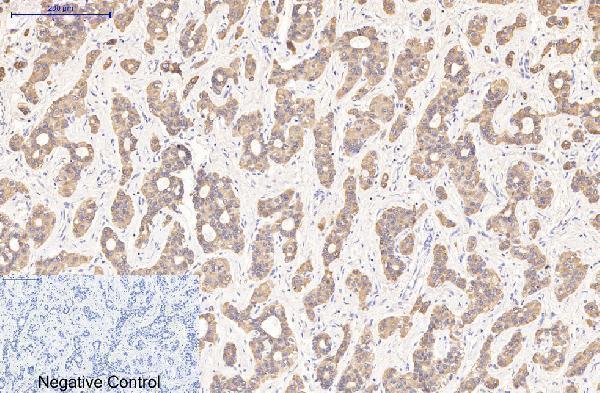 Immunohistochemistry validation of KRT16 using Anti-CK16 KRT16 Monoclonal Antibody (M03393-1)