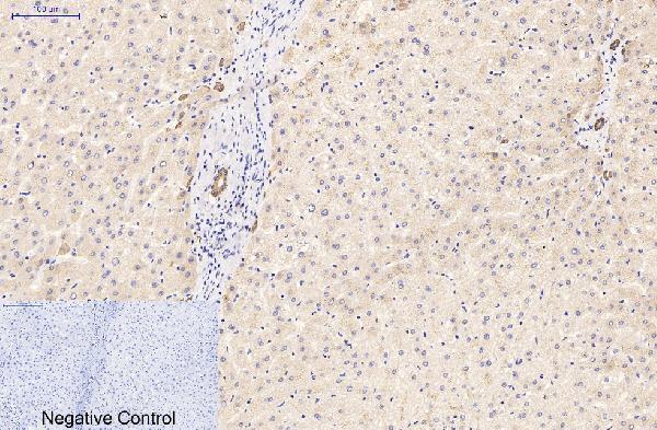 m03393 1 krt16 primary antibodyes ihc testing 4