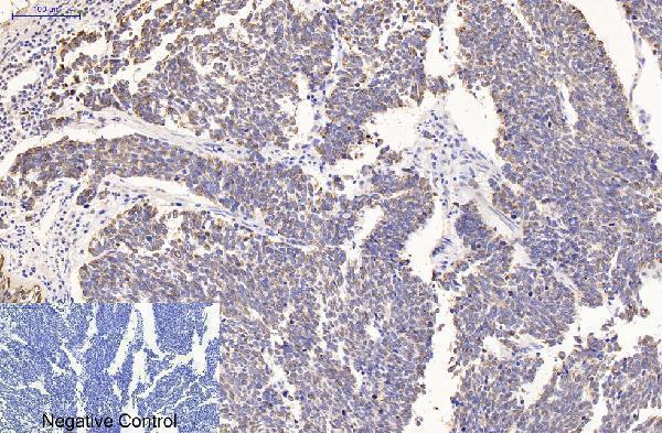m03393 1 krt16 primary antibodyes ihc testing 5