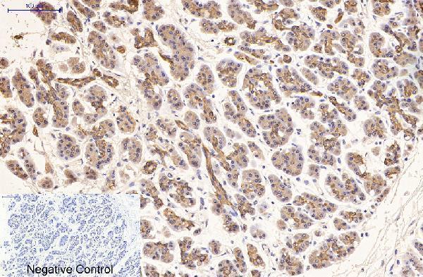 m03393 1 krt16 primary antibodyes ihc testing 7