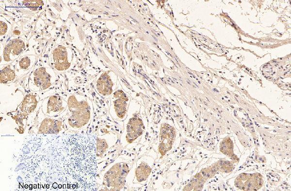 m03393 1 krt16 primary antibodyes ihc testing 8