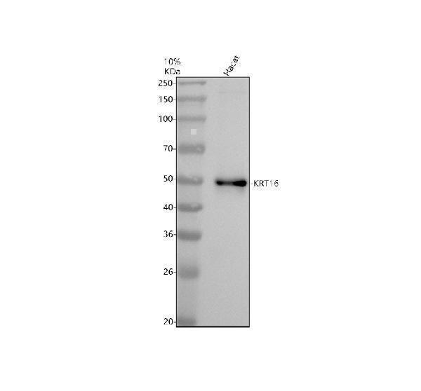 Western blot analysis of KRT16 using anti-KRT16 antibody (M03393)