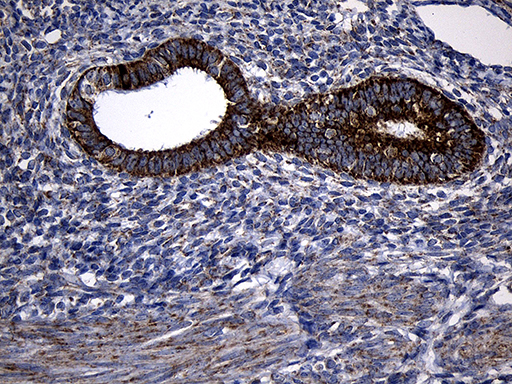 Immunohistochemical staining of paraffin-embedded Human endometrium tissue within the normal limits using anti-PCCA mouse monoclonal antibody