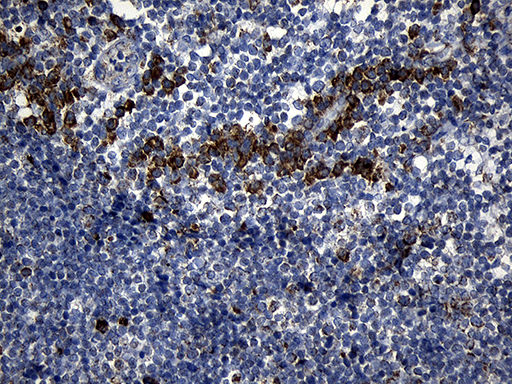 Immunohistochemical staining of paraffin-embedded Human tonsil within the normal limits using anti-PCCA mouse monoclonal antibody