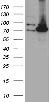 HEK293T cells were transfected with the pCMV6-ENTRY control (Left lane) or pCMV6-ENTRY PCCA (Right lane) cDNA for 48 hrs and lysed