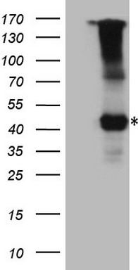m03401 anti il12rb1 mouse monoclonal antibody clone id oti1a6 wb testing 1