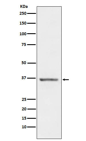 Western blot analysis of STC1 expression in Human Prostate lysate