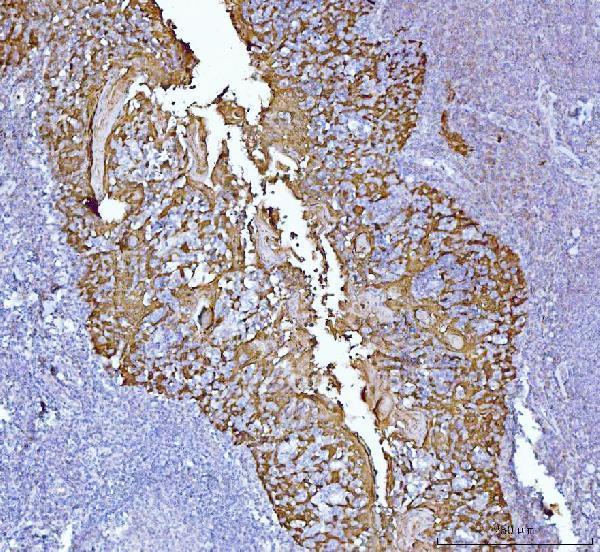 IHC analysis of MASPIN using anti-MASPIN antibody (M03409)
