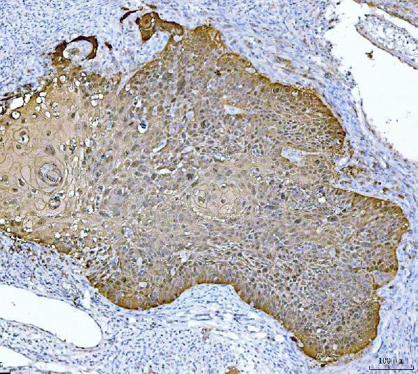  IHC analysis of MASPIN using anti-MASPIN antibody (M03409)