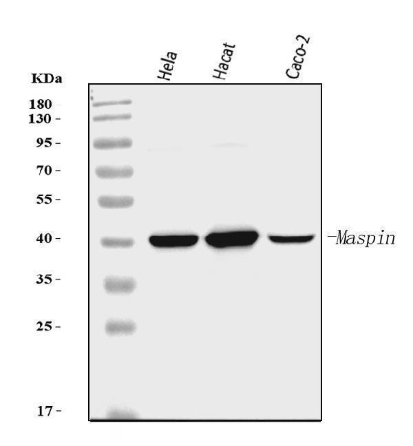  Western blot analysis of MASPIN using anti-MASPIN antibody (M03409)
