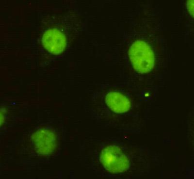 Immunocytochemistry of HeLa cells using anti-DBC1 mouse mAb diluted 1:200