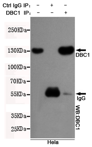 Immunoprecipitation analysis of Hela cell lysates using DBC1 mouse mAb