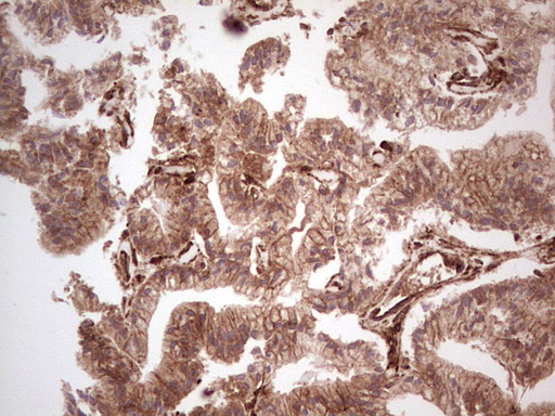 m03415 anti galectin 9 lgals9 mouse monoclonal antibody clone id oti1d12 ihc testing 11
