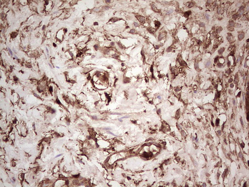 m03415 anti galectin 9 lgals9 mouse monoclonal antibody clone id oti1d12 ihc testing 12