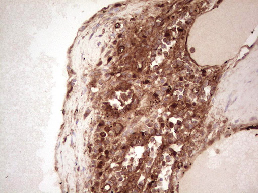 m03415 anti galectin 9 lgals9 mouse monoclonal antibody clone id oti1d12 ihc testing 13