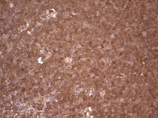 m03415 anti galectin 9 lgals9 mouse monoclonal antibody clone id oti1d12 ihc testing 14
