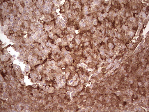 m03415 anti galectin 9 lgals9 mouse monoclonal antibody clone id oti1d12 ihc testing 15