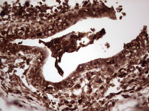 m03415 anti galectin 9 lgals9 mouse monoclonal antibody clone id oti1d12 ihc testing 16