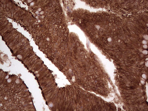 m03415 anti galectin 9 lgals9 mouse monoclonal antibody clone id oti1d12 ihc testing 18