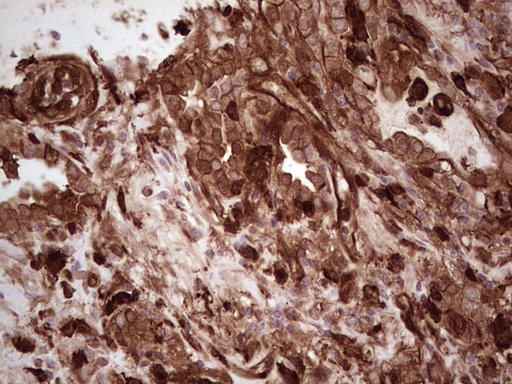 m03415 anti galectin 9 lgals9 mouse monoclonal antibody clone id oti1d12 ihc testing 2