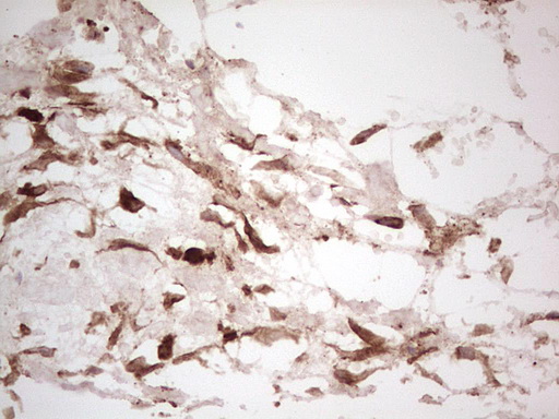 m03415 anti galectin 9 lgals9 mouse monoclonal antibody clone id oti1d12 ihc testing 20