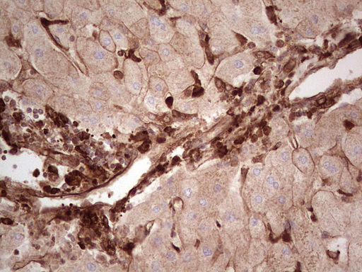 m03415 anti galectin 9 lgals9 mouse monoclonal antibody clone id oti1d12 ihc testing 21