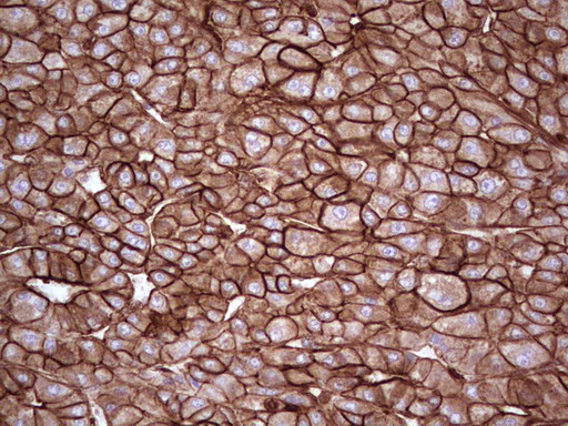 m03415 anti galectin 9 lgals9 mouse monoclonal antibody clone id oti1d12 ihc testing 22