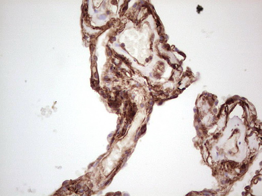 m03415 anti galectin 9 lgals9 mouse monoclonal antibody clone id oti1d12 ihc testing 23