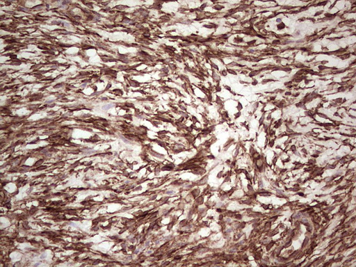 m03415 anti galectin 9 lgals9 mouse monoclonal antibody clone id oti1d12 ihc testing 3