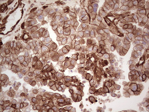 m03415 anti galectin 9 lgals9 mouse monoclonal antibody clone id oti1d12 ihc testing 4