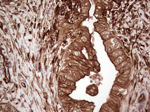 m03415 anti galectin 9 lgals9 mouse monoclonal antibody clone id oti1d12 ihc testing 6