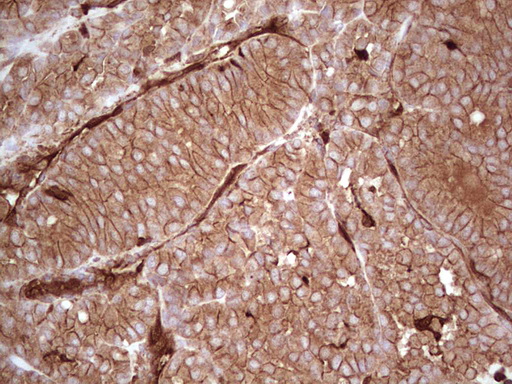 m03415 anti galectin 9 lgals9 mouse monoclonal antibody clone id oti1d12 ihc testing 7