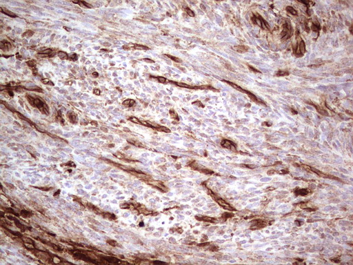 m03415 anti galectin 9 lgals9 mouse monoclonal antibody clone id oti1d12 ihc testing 8