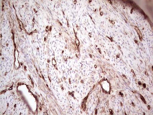 m03415 anti galectin 9 lgals9 mouse monoclonal antibody clone id oti1d12 ihc testing 9