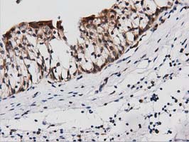 m03417 1 anti pepd mouse monoclonal antibody clone id oti1b7 ihc testing 5