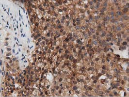 m03417 1 anti pepd mouse monoclonal antibody clone id oti1b7 ihc testing 6
